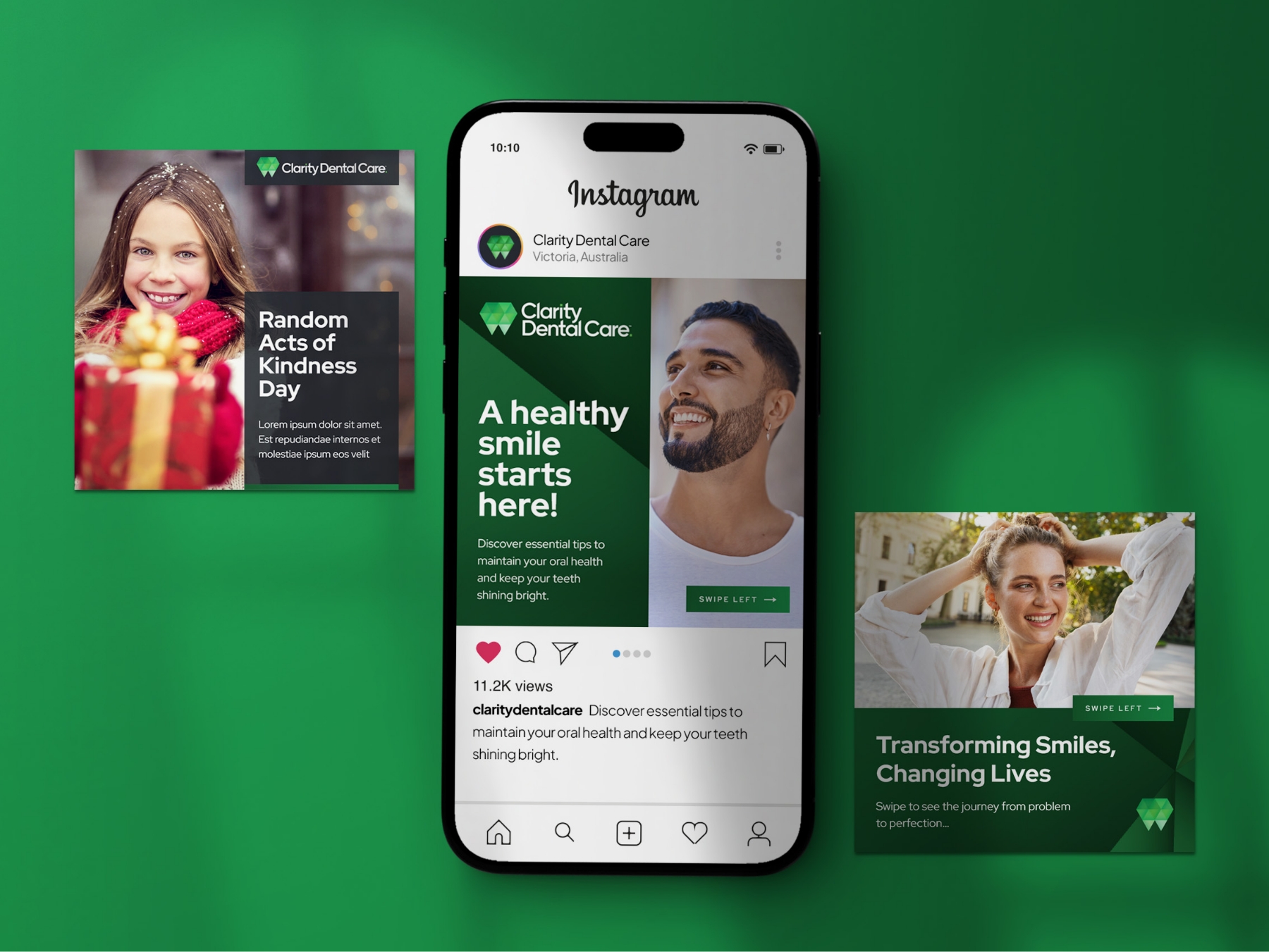 Clarity Dental Care Instagram Posts